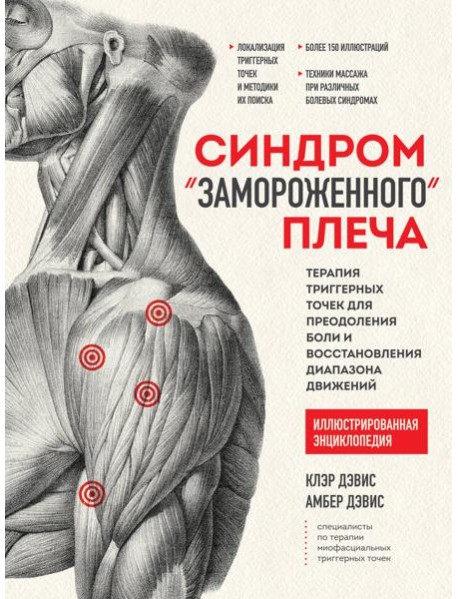 Синдром 