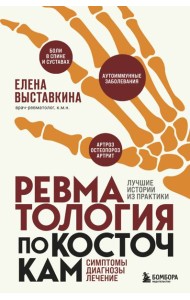 Ревматология по косточкам. Симптомы, диагнозы, лечение