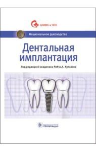 Дентальная имплантация: национальное руководство