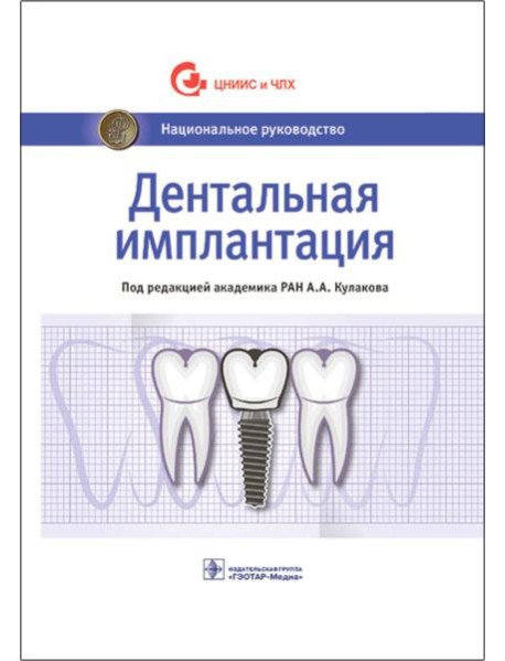 Дентальная имплантация: национальное руководство