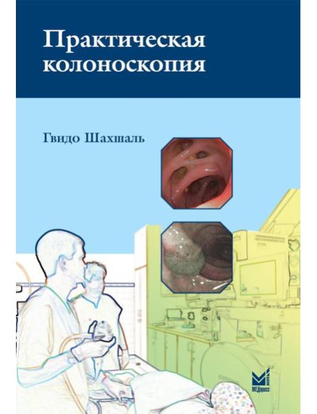 Практическая колоноскопия. Методика, рекомендации, советы и приемы. 3-е изд