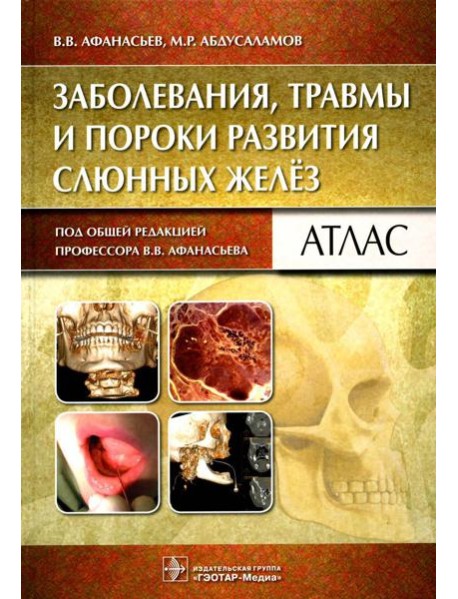 Заболевания, травмы и пороки развития слюнных желез: Атлас