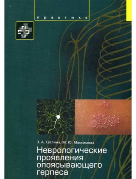 Неврологические проявления опоясывающего герпеса. Пособие для врачей
