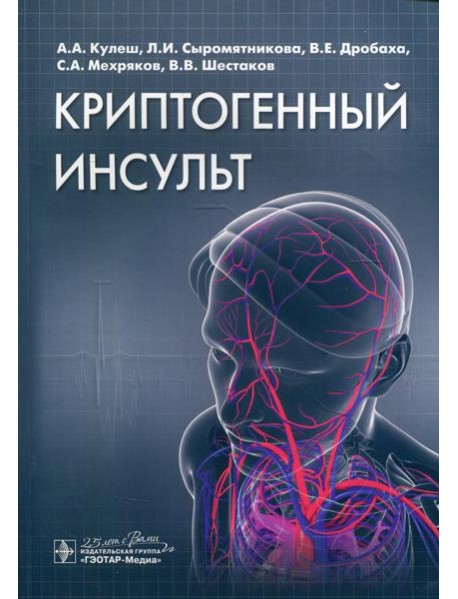Криптогенный инсульт: руководство
