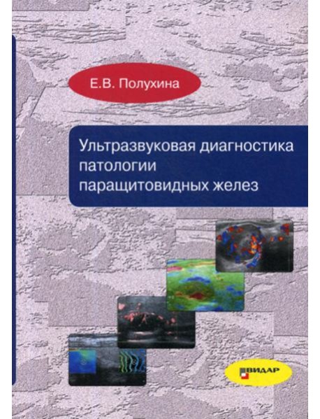 Ультразвуковая диагностика патологии паращитовидных желез