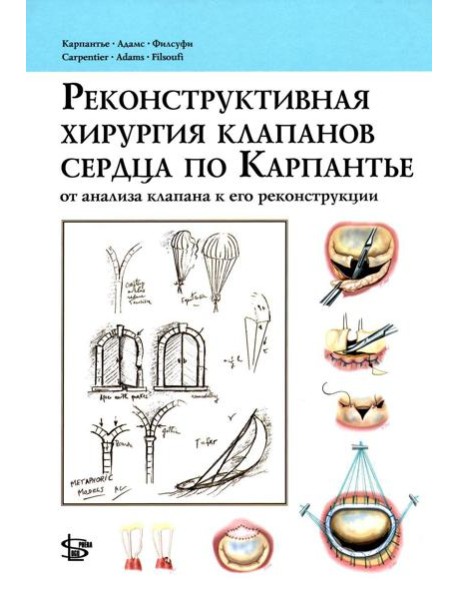 Реконструктивная хирургия клапанов сердца по Карпантье: от анализа клапана к его реконструкции