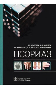 Псориаз