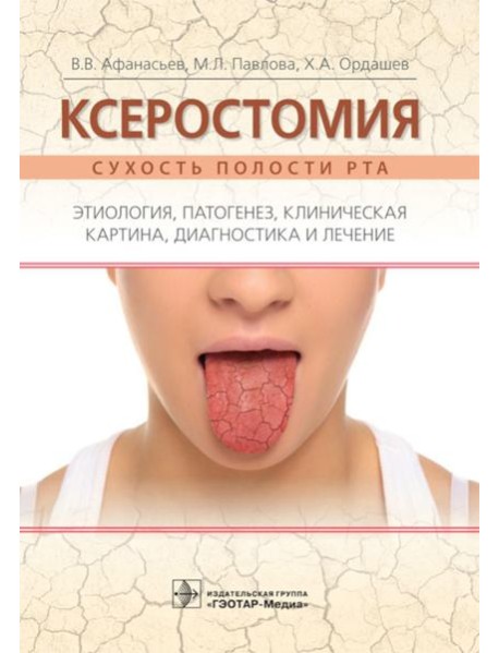 Ксеростомия. Сухость полости рта. Этиология, патогенез, клиническая картина, диагностика и лечение