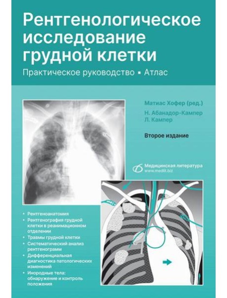 Рентгенологическое исследование грудной клетки. Практическое руководство. Атлас