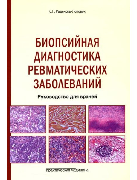 Биопсийная диагностика ревматических заболеваний. Руководство для врачей