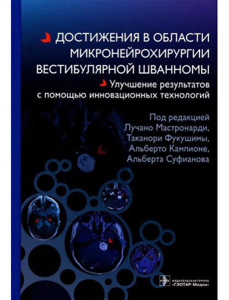 Достижения в области микронейрохирургии вестибулярной шванномы. Улучшение результатов с помощью инновационных технологий