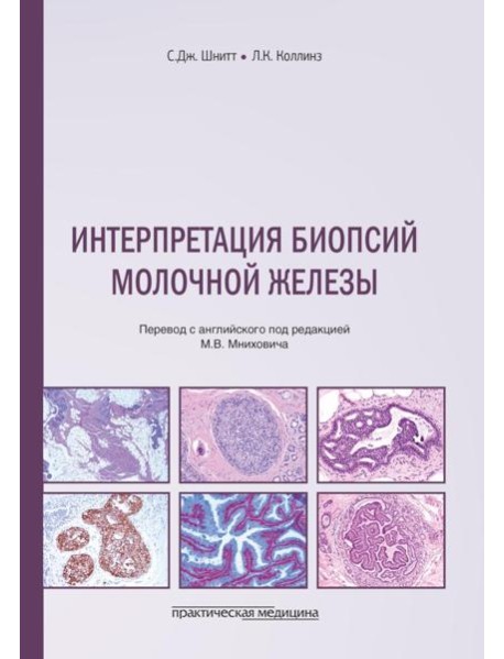 Интерпретация биопсий молочной железы