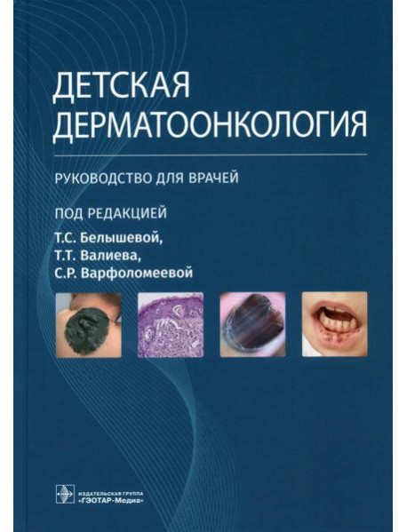 Детская дерматоонкология: руководство для врачей
