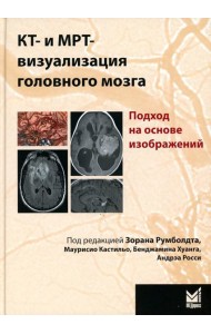 КТ- и МРТ- визуализация головного мозга. Подход на основе изображений. 2-е изд
