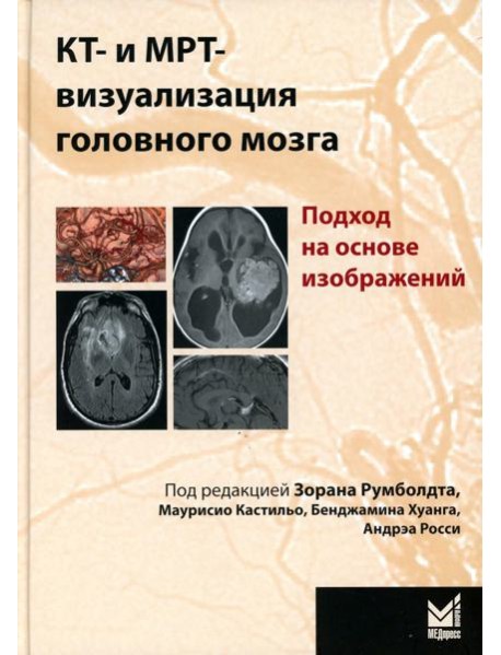 КТ- и МРТ- визуализация головного мозга. Подход на основе изображений. 2-е изд