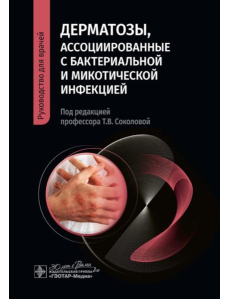 Дерматозы, ассоциированные с бактериальной и микотической инфекцией: руководство для врачей