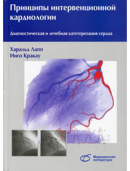 Принципы интервенционной кардиологии. Диагностическая и лечебная катетеризация сердца