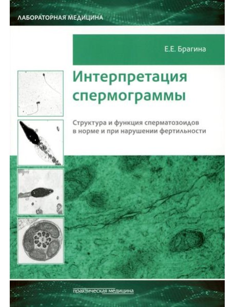 Интерпретация спермограммы. Структура и функция сперматозоидов в норме и при нарушении фертильности