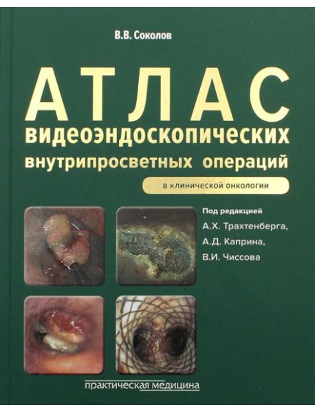 Атлас видеоэндоскопических внутрипросветных операций в клинической онкологии