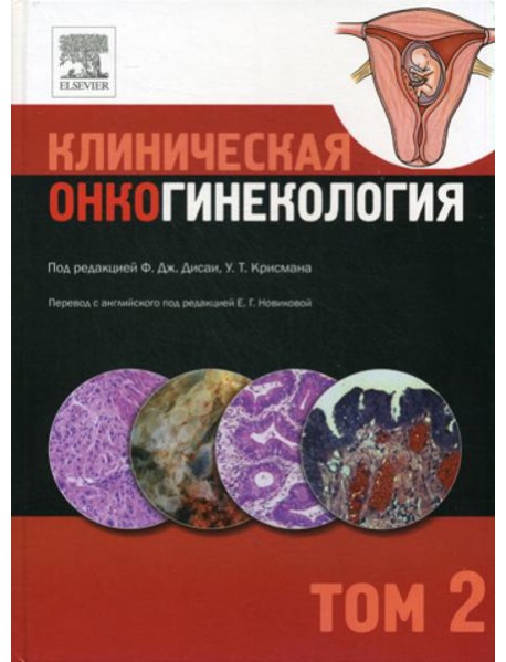Клиническая онкогинекология. В 3 т. Т. 2