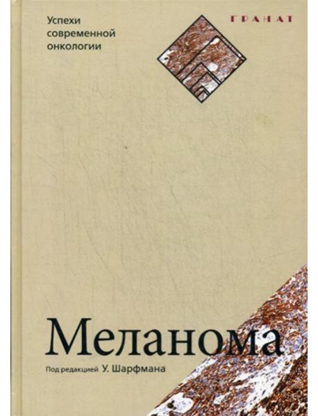 Меланома. Успехи современной онкологии