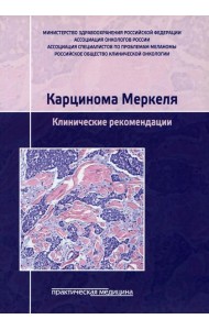 Карцинома Меркеля. Клинические рекомендации