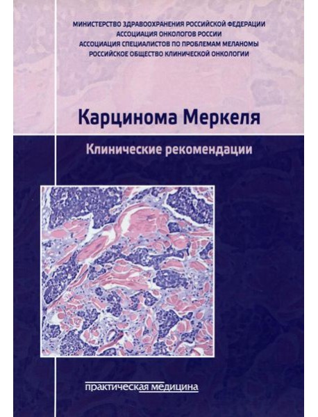 Карцинома Меркеля. Клинические рекомендации