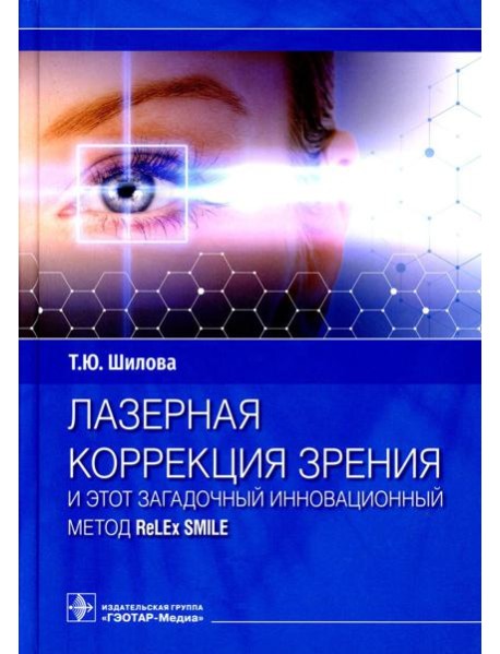 Лазерная коррекция зрения и этот загадочный инновационный метод ReLEx SMILE