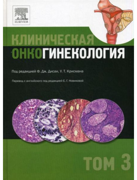 Клиническая онкогинекология. В 3 т. Т. 3