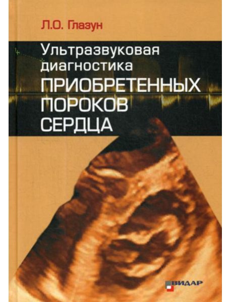 Ультразвуковая диагностика приобретенных пороков сердца