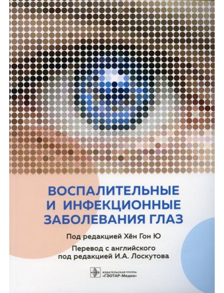 Воспалительные и инфекционные заболевания глаз