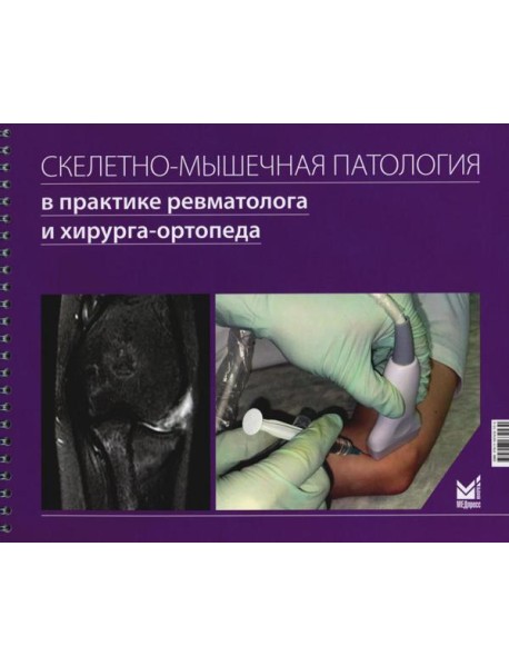 Скелетно-мышечная патология в практике ревматолога и хирурга-ортопеда: Краткое иллюстрированное руководство