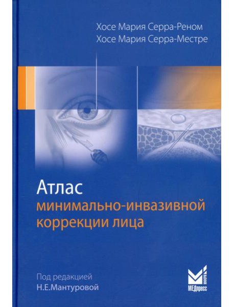 Атлас минимально-инвазивной коррекции лица. Омоложение лица объемным липофилингом