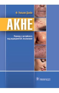 Акне