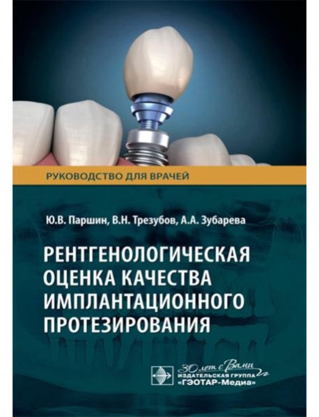 Рентгенологическая оценка качества имплантационного протезирования: руководство для врачей