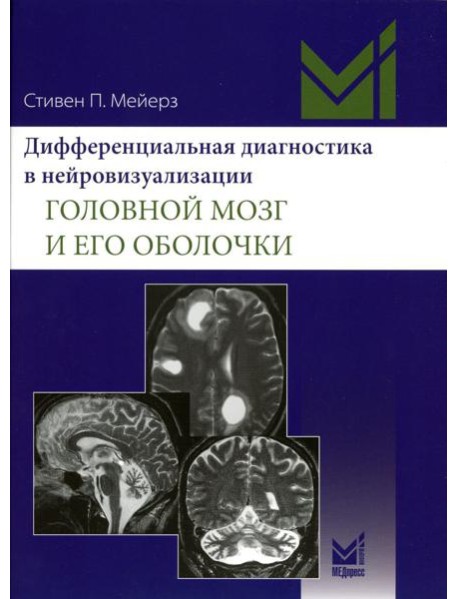 Дифференциальная диагностика в нейровизуализации. Головной мозг и его оболочки