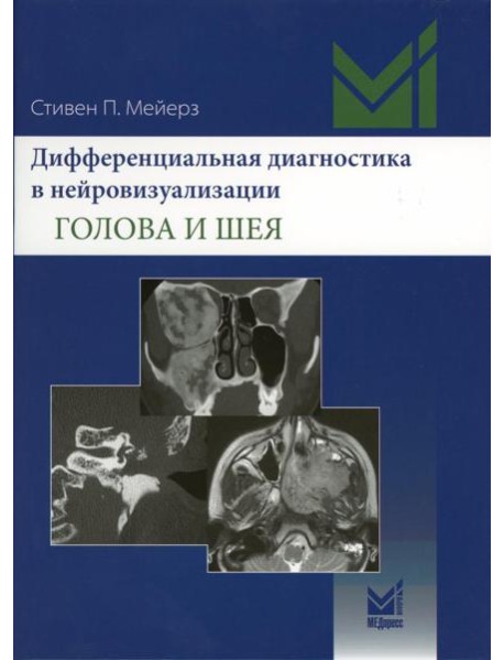 Дифференциальная диагностика в нейровизуализации. Голова и шея