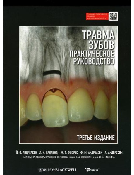 Травма зубов. Практическое руководство. 3-е изд