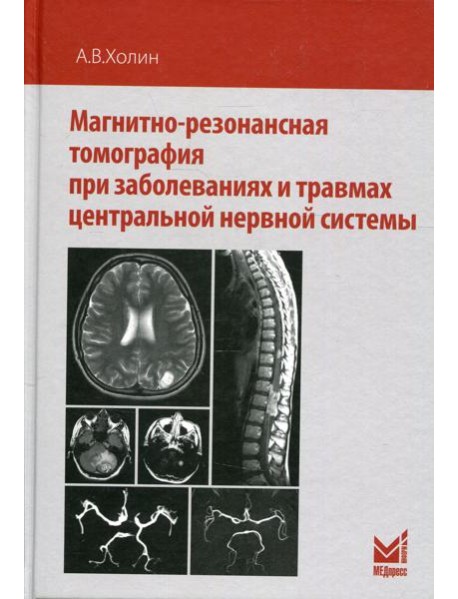 Магнитно-резонансная томография при заболеваниях и травмах центральной нервной системы. 2-е изд