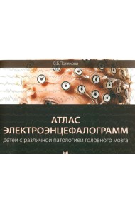 Атлас электроэнцефалограмм детей с различной патологией головного мозга. 2-е изд