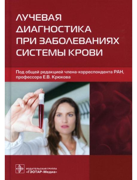 Лучевая диагностика при заболеваниях системы крови