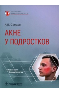 Акне у подростков