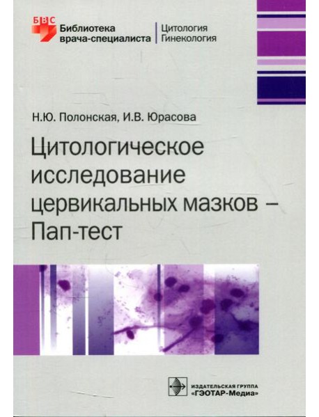 Цитологическое исследование цервикальных мазков - Пап-тест