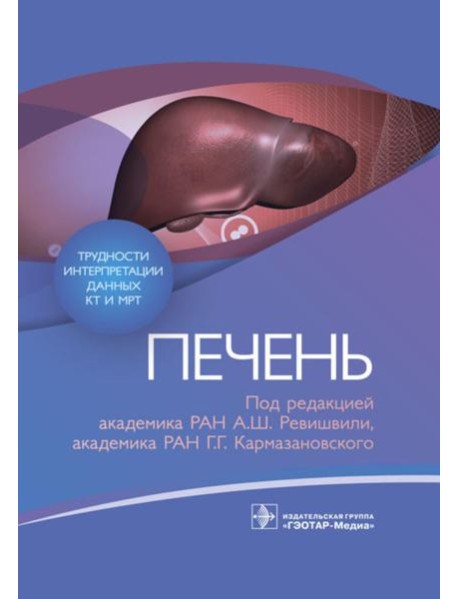 Трудности интерпретации данных КТ и МРТ: печень