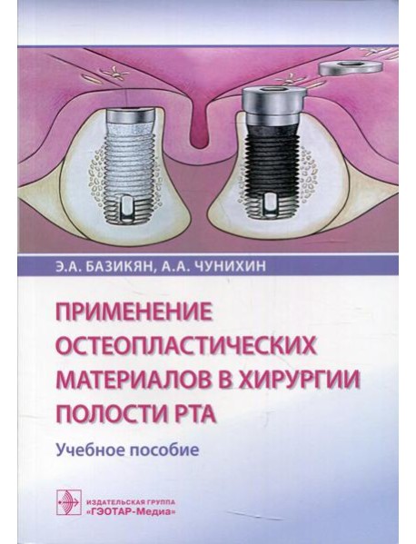 Применение остеопластических материалов в хирургии полости рта: Учебное пособие