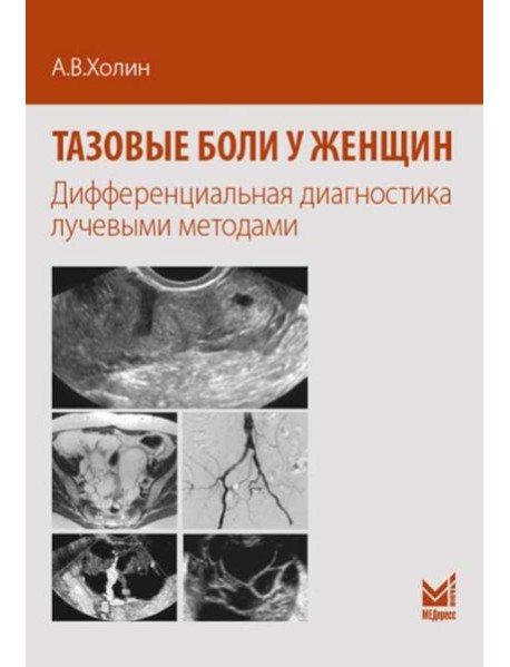 Тазовые боли у женщин. Дифференцианальная диагностика лучевыми методами