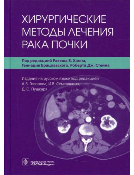 Хирургические методы лечения рака почки