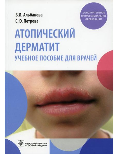Атопический дерматит: Учебное пособие для врачей