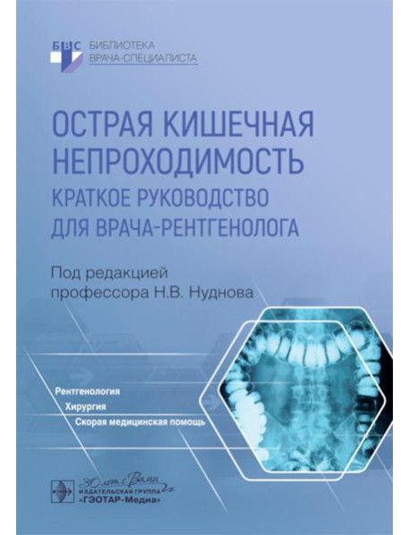 Острая кишечная непроходимость. Краткое руководство для врача-рентгенолога