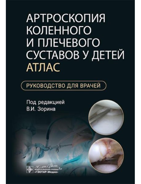 Артроскопия коленного и плечевого суставов у детей. Атлас : руководство для врачей